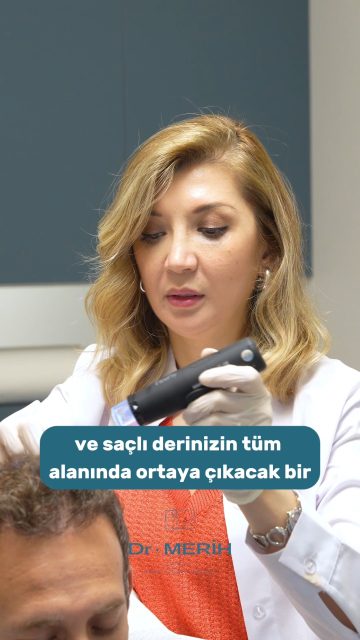 Saç ekiminde süreç, işlem günüyle sınırlı değil; düzenli takip de sonucun önemli bir parçası. ✨​6. ay kontrolündeki hastamızda mevcut gelişimi değerlendiriyor, sürecin ilerleyen dönemlerini kişiye özel olarak takip ediyoruz.​Saç ekimi sonuçları kişiden kişiye farklılık gösterebilir ve nihai görünüm için sürecin tamamlanması önemlidir.​📞 0533 522 56 26 & 0543 664 56 26​
📧 info@drmerihtombul.com​
🌐 drmerihtombul.com​#SaçEkimi #SaçEkimiSonrası #6AyKontrolü #SaçRestorasyonu #DrMerihTombul​